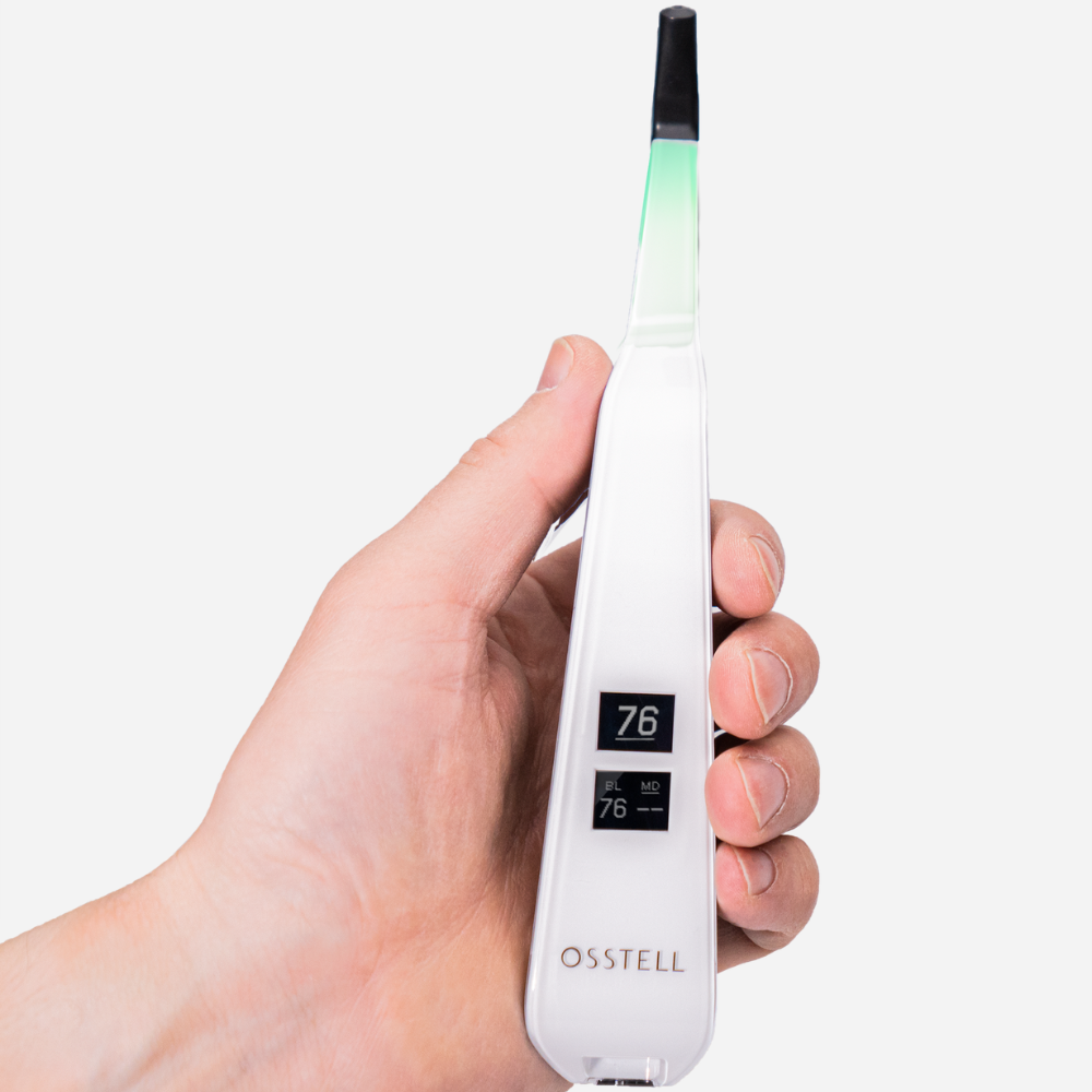 Osstell Beacon – Implant Stability Measurement